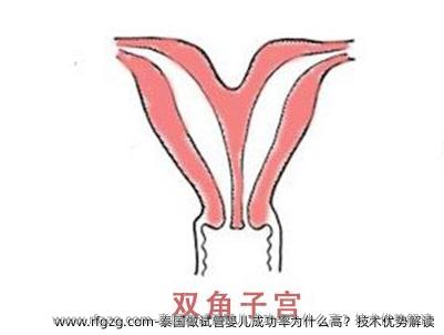泰国做代孕成功率为什么高？技术优势解读