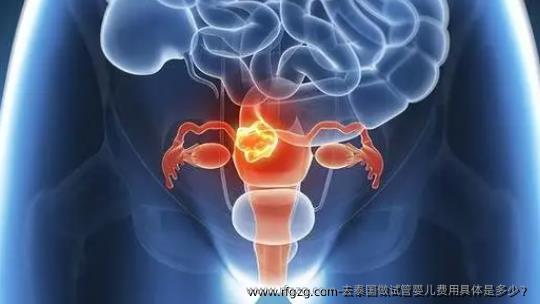 去泰国做代孕费用具体是多少？