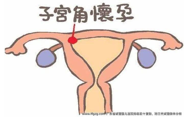 广东省代孕医院排名前十更新，附三代试管条件分析