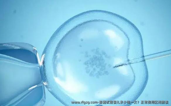 美国代孕多少钱一次？正常费用区间解读