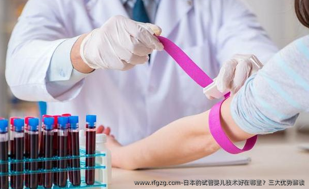 日本的代孕技术好在哪里？三大优势解读
