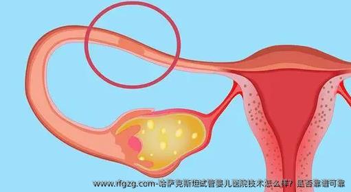 哈萨克斯坦代孕医院技术怎么样？是否靠谱可靠